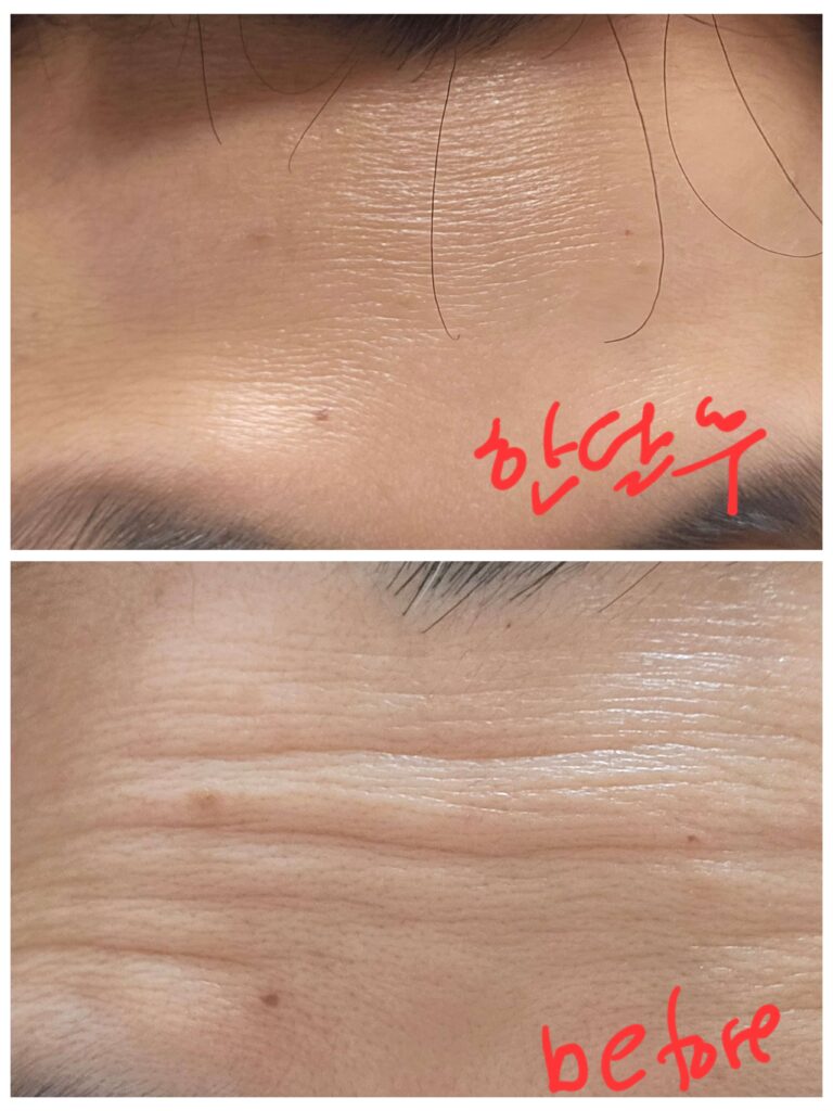 한달 후 