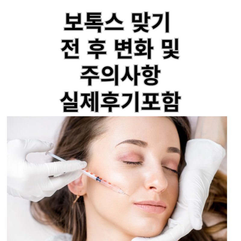 보톡스맞는모습썸네일