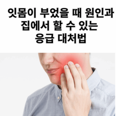 잇몸이 부었을 때 원인과 집에서 할 수 있는 응급 대처법